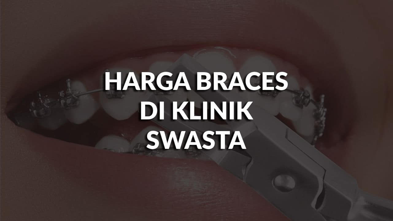 harga braces di klinik swasta