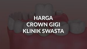 harga crown gigi klinik swasta & kerajaan terkini malaysia