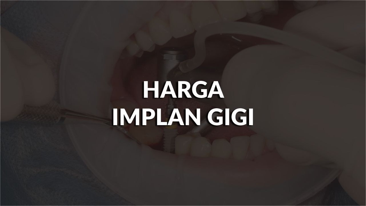 senarai harga implan gigi di klinik kerajaan terkini