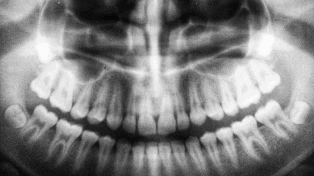 jenis-jenis xray gigi dan fungsinya