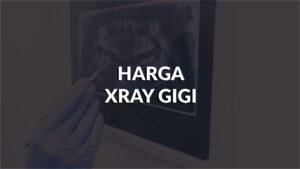 senarai harga xray gigi terkini, all klinik di malayisa