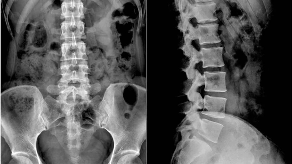 faktor yang mempengaruhi harga x ray klinik swasta