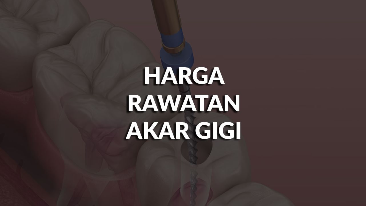 harga rawatan akar gigi terkini malaysia, swasta & kerajaan