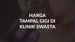 harga tampal gigi di klinik swasta malaysia terkini