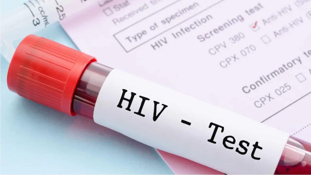 jenis dan harga hiv test di klinik swasta