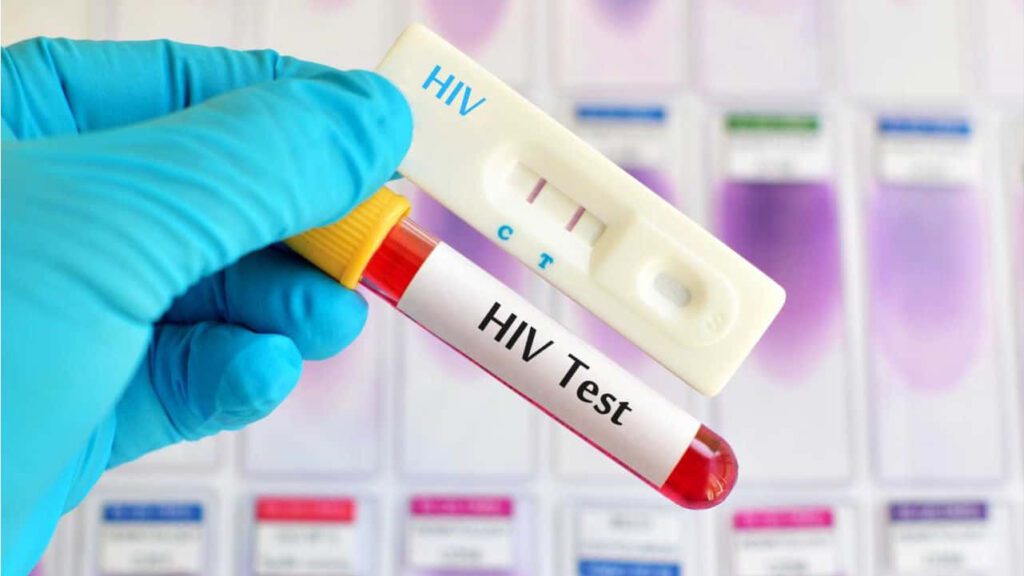 kebimbangan berkaitan hiv test