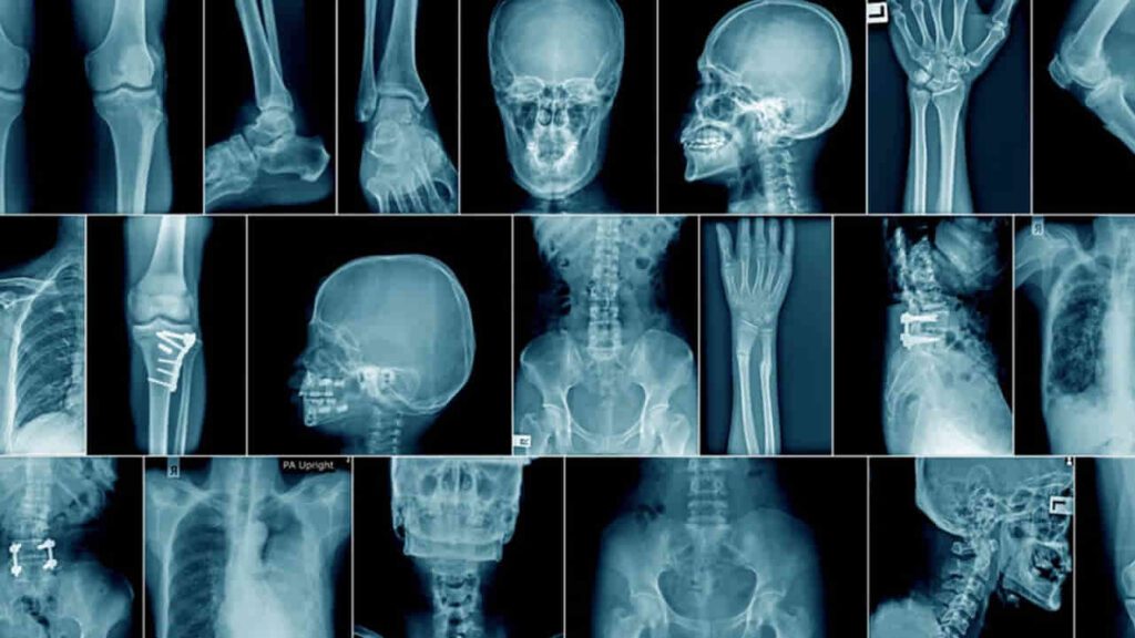 mengapa memilih klinik swasta untuk x ray