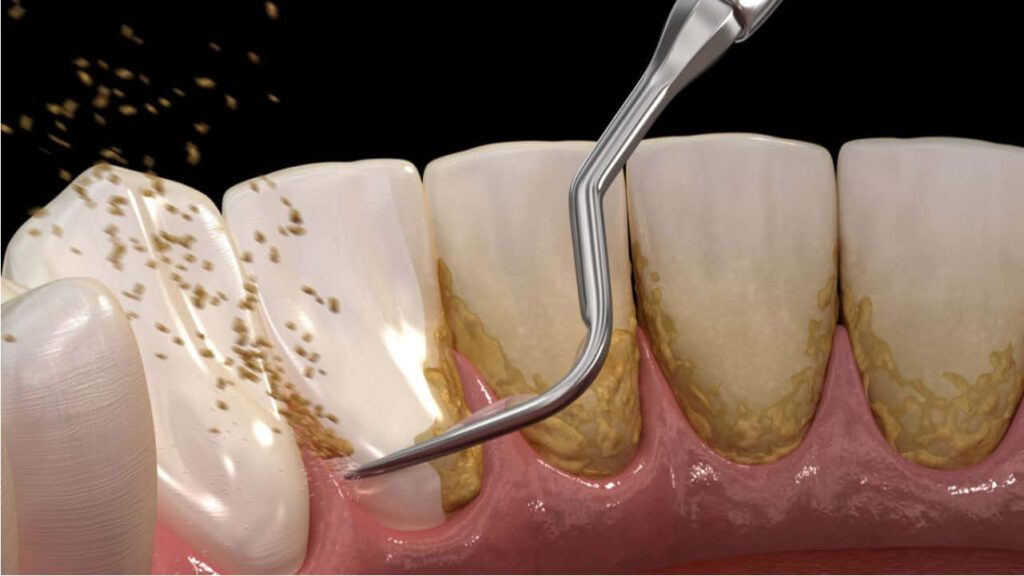 panduan memilih klinik swasta untuk cuci gigi